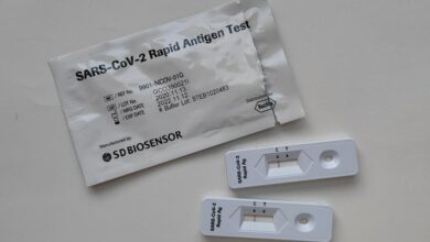 لا مزيد من اختبارات كورونا المجانية في ألمانيا اعتبارًا من 11 أكتوبر!